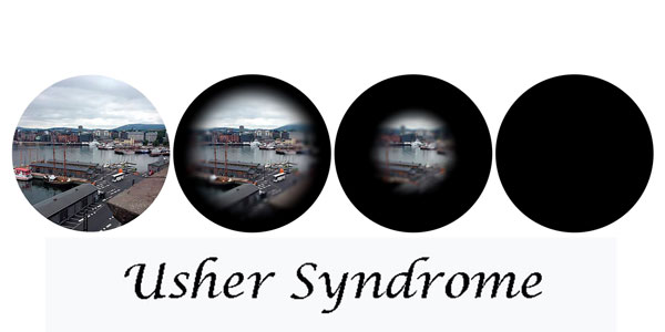 Een voorbeeld van de verkleining van het gezichtsveld van Usher, aan de hand van 4 foto's van een haven. Daaronder de tekst 'Usher syndrome'